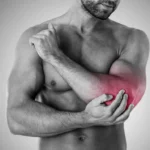 Persona con tendinitis en el codo mostrando dolor típico en deportistas.