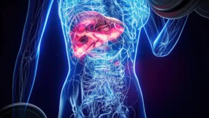 Anatomía en rayos X de una mujer realizando rizos de bíceps, ilustrando la importancia de los suplementos y daño hepático